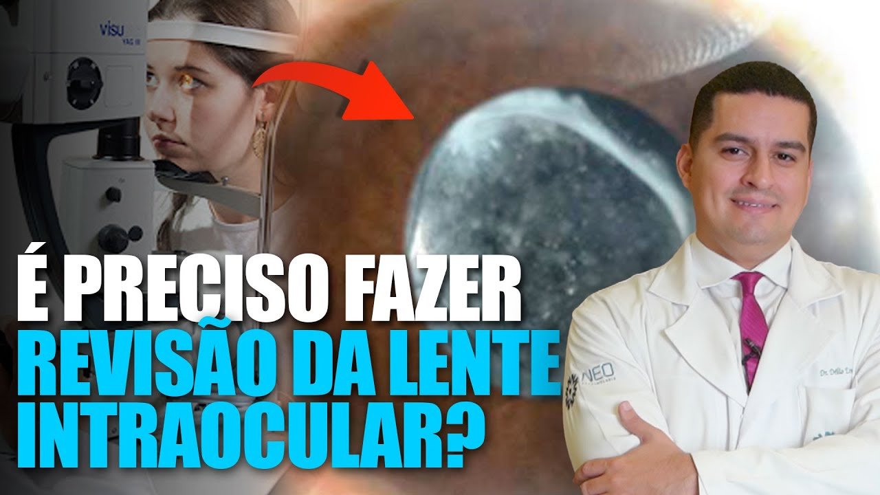 É Preciso Fazer Revisão da Lente Intraocular?