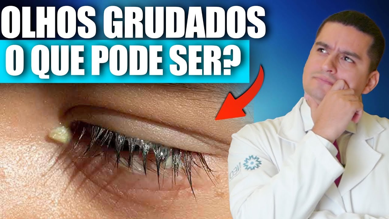 Por que acordamos com os olhos grudados? As 3 causas mais comuns