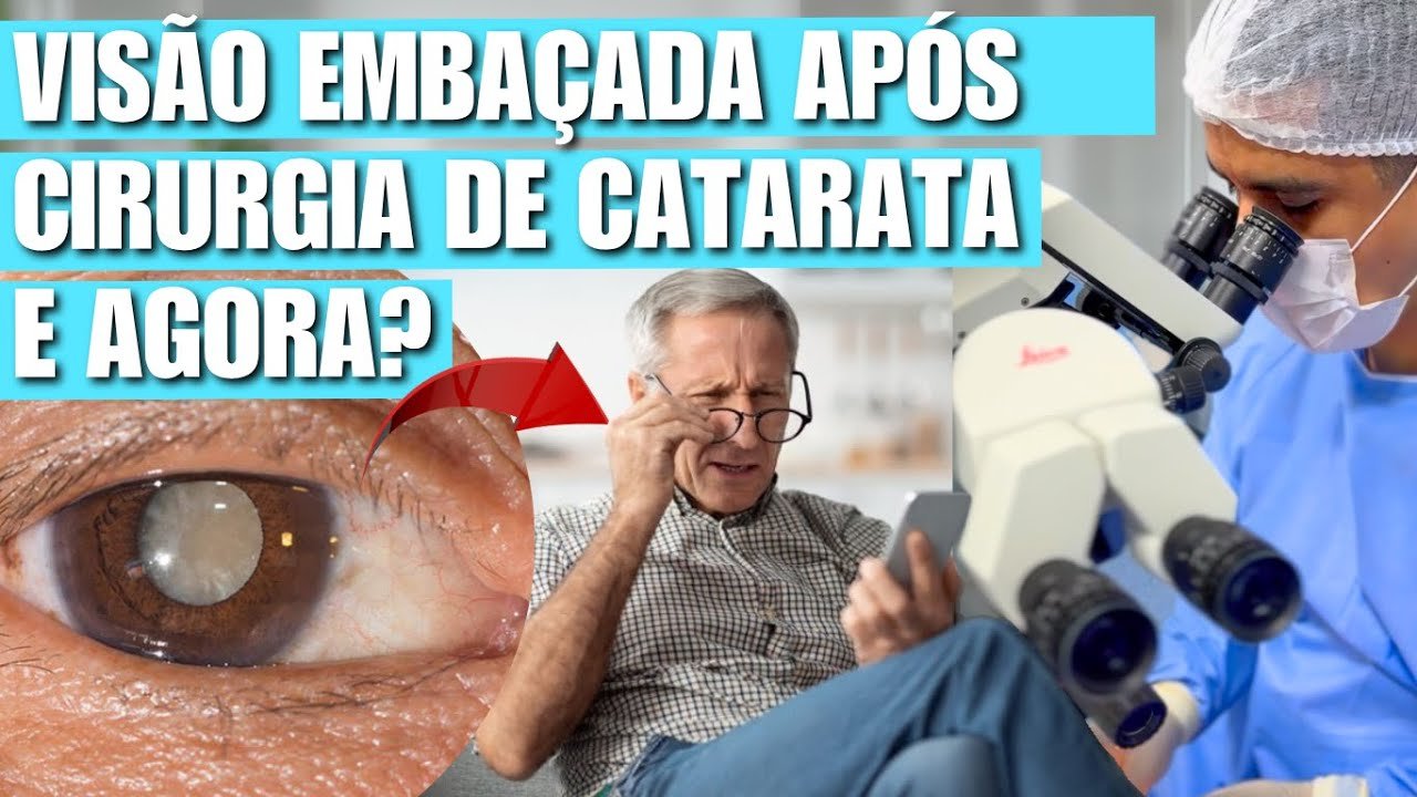 Visão embaçada depois da cirurgia de catarata: Quais as causas e o que fazer?