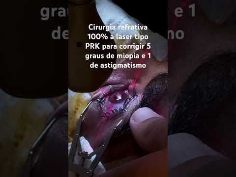 Cirurgia refrativa para corrigir miopia e astigmatismo