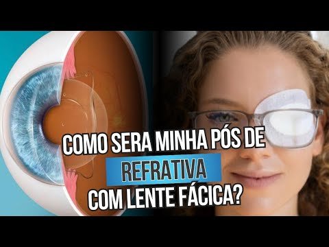 Como será a pós da minha refrativa com lente fácica?