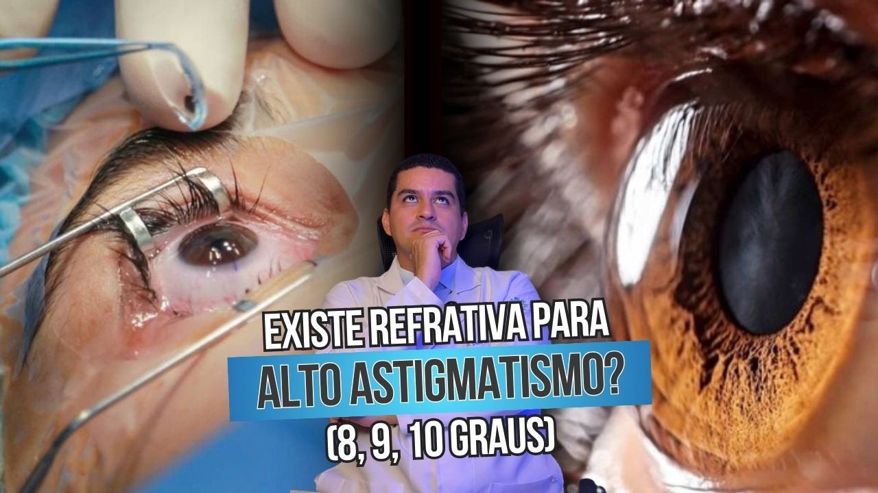 Existe cirurgia refrativa para astigmatismo alto?