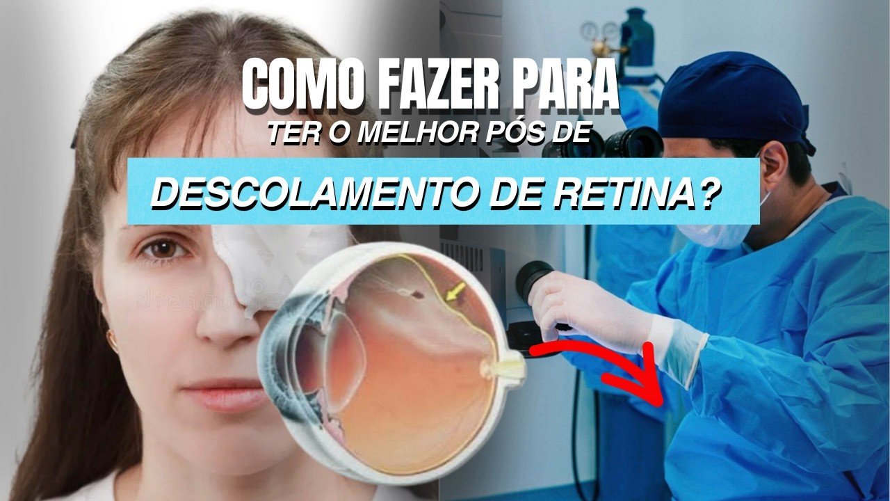 Como ter a melhor recuperação após um descolamento de retina