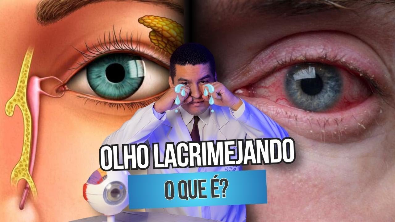 Olho lacrimejando muito: o que pode ser?