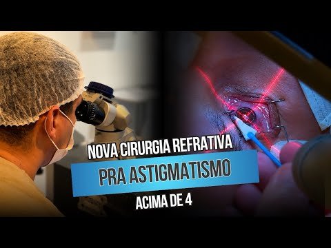 Nova cirurgia refrativa pra astigmatismo acima de 4