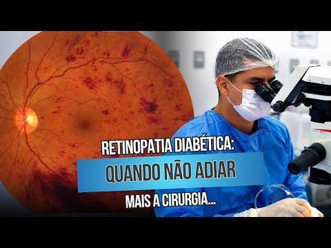 Retinopatia Diabética: Quando não adiar mais a cirurgia…